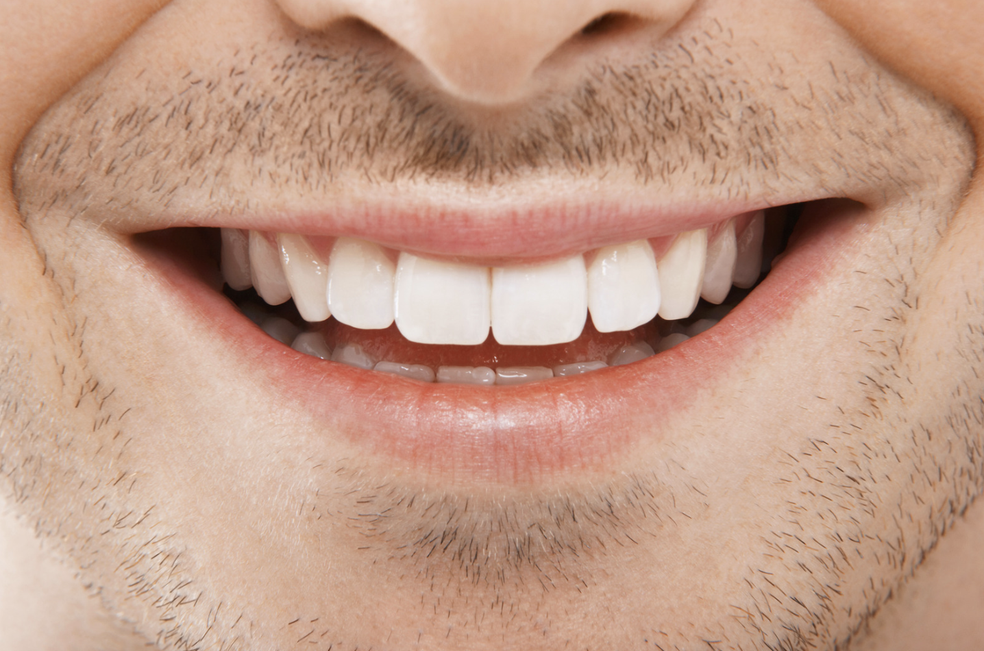 Enhancing Your Professional Image: How Teeth Whitening Can Make a Difference
